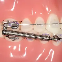 Nashville Braces, Franklin Invisalign, Brentwood TN Braces